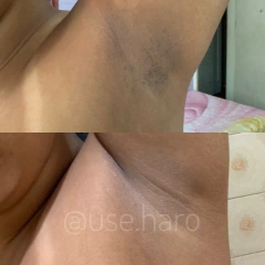 DUPLA TCHAU MANCHINHAS - CORPORAL E FACIAL - comprar online