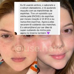 SABONETE REVITALIZANTE TRILOGY - ROSA MOSQUETA - comprar online