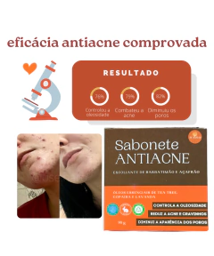 TRIO ANTIACNE - 3 SABONETES DE BARBATIMÃO na internet