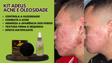 Imagem do banner rotativo USE HARO COSMÉTICOS