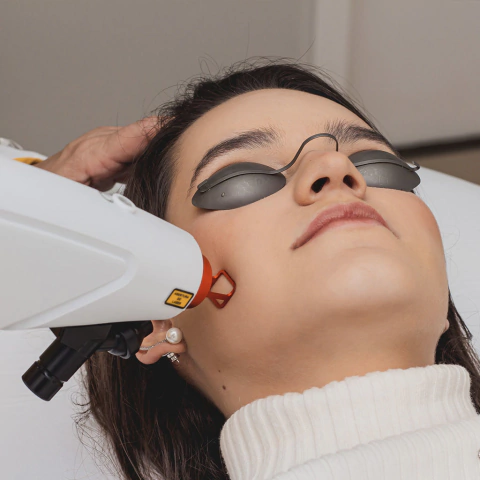 Laser de Rejuvenescimento Facial, Pescoço e Colo