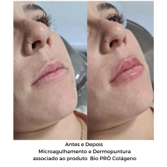 Sérum Bio Pró Colágeno - Linha Profissional - 30ml