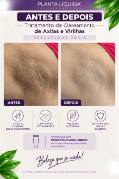 Kit Para Clareamento De Manchas Em Virilhas E Axilas - loja online
