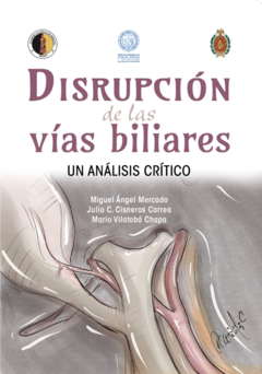 Disrupción de las Vías Biliares