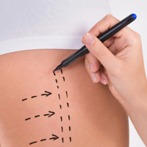 CORRECCIONES x 5 MÓDULOS