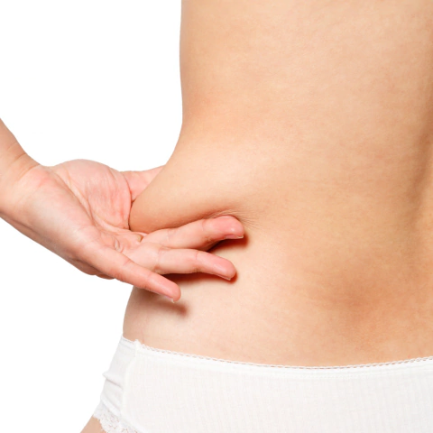 LIPO DERMOFREEZ x 3 MÓDULOS