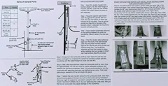 Imagen de Sistema Completo De Reparación De Fregaderos Never Fall