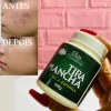 Creme Tira Manchas