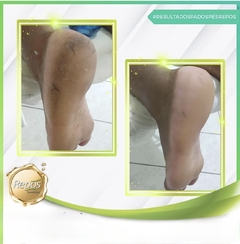 Amaciante de cutículas e calosidades Repôs - loja online