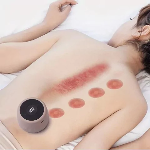 MASSAGEM, SUCÇÃO, MASSOTERAPIA