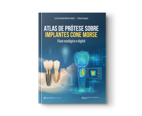 ANDRE, DAYUBE | Atlas de Prótese sobre Implantes Cone morse - Fluxo analógico e digital | Luiz Fernando André, Ulisses Dayube