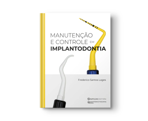 LAGES | Manutenção e Controle em Implantodontia | Frederico Santos Lages