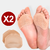 SET X2 Almohadilla Gel para Dolor de Metatarso