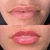 Revitalização Labial com Microagulhamento - loja online