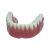Macro Modelo Anatômico Odontológico Mandíbula Overdenture Acrílica com 2 O'Rings e Prótese Inferior - Prevenção Express