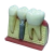Macro Modelo Anatômico Odontológico com Ponte Fixa 3 Elementos e Macro Implante