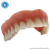 Macro Modelo Anatômico Odontológico Overdenture em Acrílico com 4 implantes Barra Clip na internet