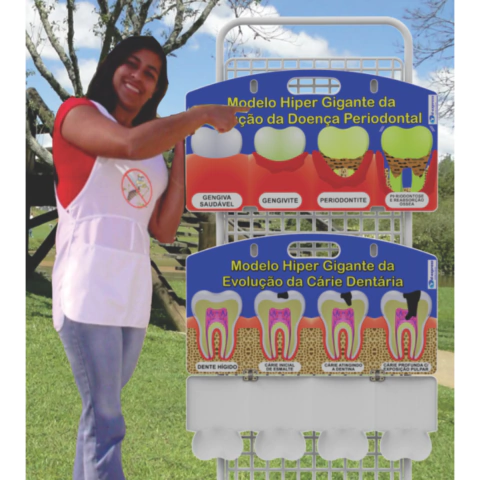 Macro Modelo Anatômico Odontológico - Kit Hiper Macro Cárie e Doença Periodontal