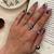 Anillos 