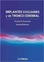 IMPLANTES COCLEARES Y DE TRONCO CEREBRAL