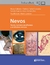 NEVOS. NEVOS, TUMORES NEVIFORMES Y SÍNDROMES NÉVICOS