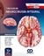 TRATADO DE NEUROCIRUG?A INTEGRAL