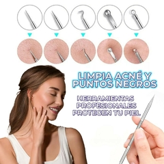 ¡Dile adiós a las imperfecciones! Kit de Herramientas para Acné y Uñas Encarnadas: 10 Piezas de Acero Inoxidable para Cuidado Preciso