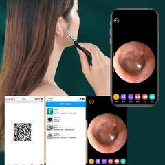 La Solución Inteligente para Oídos Limpios y Saludables | Limpiador de Oídos con Cámara Quita Cerilla en internet