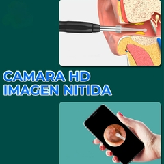 La Solución Inteligente para Oídos Limpios y Saludables | Limpiador de Oídos con Cámara Quita Cerilla - Comprayhelp