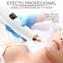 Piel Perfecta al Instante Limpiador de Poros y Extractor de Espinillas con Succión - comprar en línea