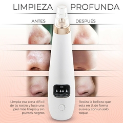 Piel Perfecta al Instante Limpiador de Poros y Extractor de Espinillas con Succión - Comprayhelp