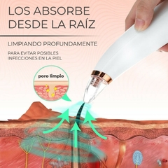 Piel Perfecta al Instante Limpiador de Poros y Extractor de Espinillas con Succión en internet
