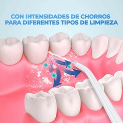 Limpieza Dental de Alta Precisión | Escalador Eléctrico Portátil y Recargable para un Cuidado Profesional - tienda en línea