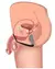 Ilustración del uso de un anillo para el pene y masajeador prostático en el cuerpo masculino.
