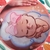 Stencil Gestacional Bebê 3 - comprar online
