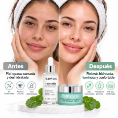 Set Rubyskin Centella Asiática Sérum 30ml + Crema 30g - comprar online