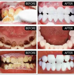 Espuma Dental Limpiadora Blanqueadora Refrescante Elimina - M&Q REGALOS