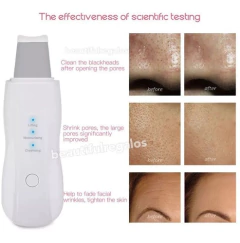 Combo Espátula Facial Ultrasonica + Nano Humidificador Spray - comprar online