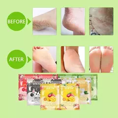 Imagen de Mascarilla Exfoliante Pies Paso 1 Y 2 Hidratante Suavizante