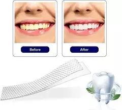 Imagen de X21 Pares Tira De Gel Blanqueador Dental 5d White Banditas