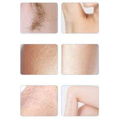 Depiladora Electrica Usb Inalambrica Corporal Facial Unisex - comprar online
