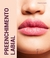 PREENCHIMENTO LABIAL COM ÁCIDO HIALURÔNICO