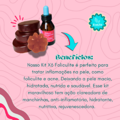 Kit Xô Foliculite | 3 Sabonetes de Gerânio com Cúrcuma + 1 Óleo de Rosa Mosqueta + Brinde Sabonete íntimo - comprar online