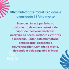 Creme Xô acne e oleosidade ultra hidratante antiacne facial | Artesanal na internet