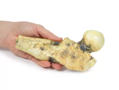 Modelo 3D de Osteossarcoma do fêmur - loja online