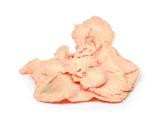 Modelo 3D de Adenocarcinoma do estômago na internet