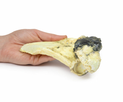 Modelo 3D de Condrossarcoma da escápula - loja online