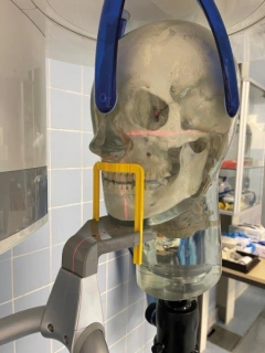 Imagem do Simulador de Cabeça com Vértebras Cervicais para Prática de Raio-X, Transparente (Phantom)
