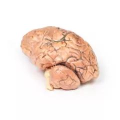 Modelo 3D de Craniofaringioma - loja online