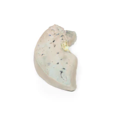 Modelo 3D de Fígado Gorduroso - comprar online